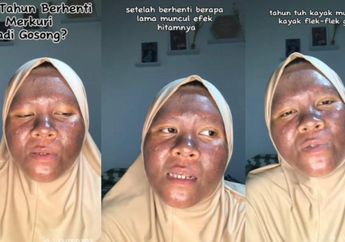 WASPADA Krim Pemutih Wajah, Begini Nasib Pilu Nur Sha, Mukanya Gosong Imbas Krim Merkuri!