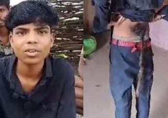Tumbuh Ekor Sepanjang 60 Cm, Bocah Laki-laki Ini Konon Titisan Hanoman, tapi Alami Nasib Miris Sepanjang Hidupnya