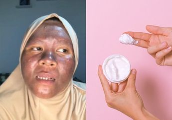 Niat Ingin Glowing, Wajah Wanita ini Gosong karena Asal Pakai Krim Pemutih, Tak Tahu Ada Kandungan ini