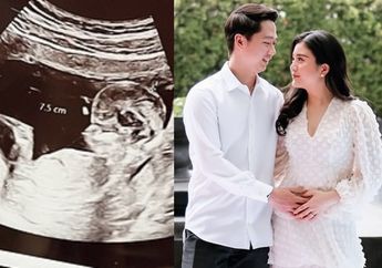 Bakal Jadi Cucu Konglomerat, Jenis Kelamin Calon Anak Pertama Kevin Sanjaya dan Valencia Tanoesoedibjo Akhirnya Terkuak!