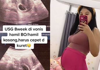 Viral Kisah Wanita Divonis Hamil Kosong tapi Menolak Kuret, Kini Masuk Kehamilan Trimester 3!