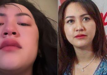 Happy Asmara Kesurupan sampai Pukul Kepalanya Sendiri hingga Bentak Pengawal, Apa Penyebabnya dari Sisi Medis?