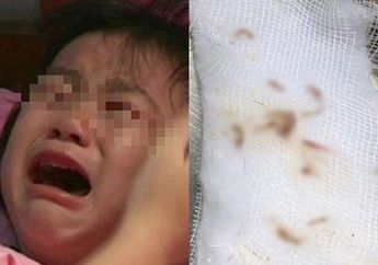 Awalnya Keluar Darah, Orang Tua Bocah 2 Tahun ini Syok Lihat Hewan Mengerikan ini Keluar dari Telinga Anaknya