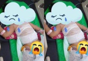 Astagfirullah, Balita di Ponorogo Kecemplung Panci Sayur Panas, Terungkap Kronologinya yang Bikin Ngilu