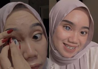 Pilu, Gadis Cantik ini Punya 7 Bola Mata Bisa Dikeluarkan dan Terjatuh, Siapa Sangka Ghina Khansa Idap Penyakit Serius ini, Begini Kisahnya