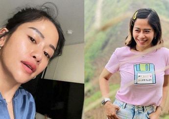 Farida Nurhan Gembira Pamer Hasil Operasi Plastik Hidung, Aksi Omay Malah Tuai Nyinyiran Netizen