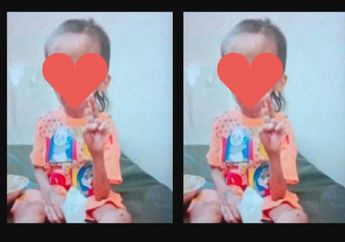 Bocah Cilik di Malang Pilu Dianiaya Keluarga Sendiri, Motif Pelaku Sepele, Kondisi Korban Memprihatinkan