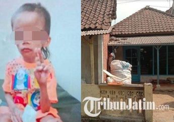 Derita Bocah 7 Tahun di Malang, Disiksa Keluarga hingga Alami Busung Lapar, Sering Digebuki Gegara Ambil Makan Tanpa Izin