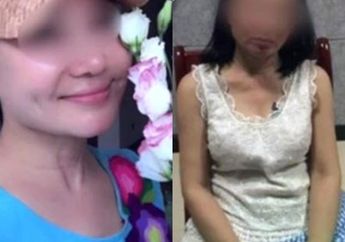 Terlilit Utang Rp63 Milliar, Nenek 60 Tahun ini Operasi Plastik Jadi Gadis Muda Untuk Hindari Polisi