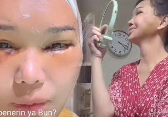 Rela Rogoh Kocek Rp 1,5 M Demi Operasi Plastik, Bunda Corla Pamer Wajah Baru, Ngaku Kini Bak Gadis 20 Tahun
