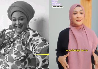 Artis Lawas ini Sukses Turun Berat Badan Hampir 100 Kg Tanpa Sedot Lemak, Penampilannya Bikin Pangling!