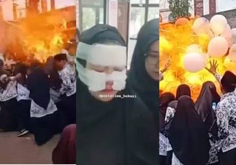 Apesnya Perayaan Hari Guru di Bekasi, Balon Gas Tetiba Meledak hingga Bikin Para Guru Alami Luka Bakar Berat pada Wajah, Begini Kondisinya!
