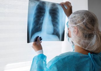 Terobosan Teknologi EBUS (Endobronchial Ultrasound) dalam Deteksi dan Penatalaksanaan Kanker Paru