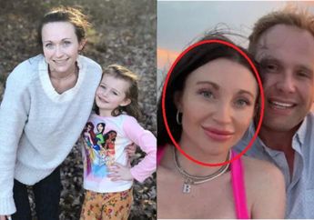 Ya Allah, Dioperasi Plastik Suami Sendiri, Wanita Ini Malah Meninggal Dunia, Orang Tua Mencak-mencak Tagih Ini ke Mantu!