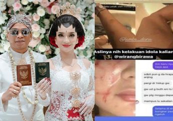 Badannya Lebam-lebam, Istri Wirang Birawa Curhat Diusir Suami saat Hamil hingga Diduga Alami KDRT, Ada Apa?