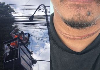 Pilu, Seorang Pria Terjerat Kabel Fiber Optik di Kramatjati, Korban Layangkan Surat ke Kapolri