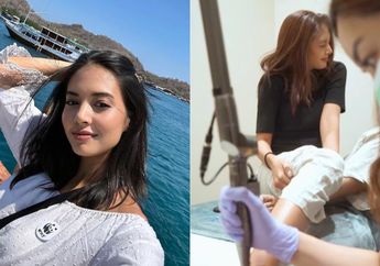 Aurelie Moeremans Putuskan Hapus Tato di Tubuhnya, Mantan sang Aktris Mendadak Tuai Kecaman karena Hal Ini