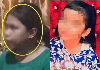 Innalillahi, Bocah 8 Tahun Tewas Dimutilasi Gegara Perhiasan Emas, Petugas Autopsi Menangis Lihat Kondisi Jenazah