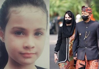 Dulu Diejek Bule Masuk Kampung, Gadis Cantik Ini Menjelma Jadi Artis Kondang hingga Dipinang Pejabat RI, Nasibnya Kini Berubah Drastis