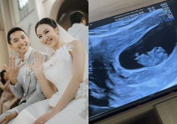 Segera Dikaruniai Momongan, Shanju Eks JKT48 dan Jonatan Christie Umumkan Kehamilan Anak Pertama