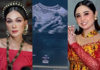Jalani Pembekuan Sel Telur, Dewi Perssik Berencana Punya Anak Kapan Saja