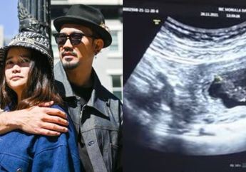 Anaknya Segera Lahir, Denny Sumargo dan Olivia Allan Belum Tentukan Bakal Lahiran Normal atau Caesar