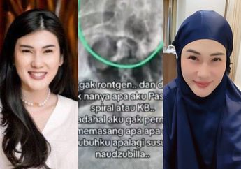 Derita Penyakit Misterius, Stevie Agnecya Disebut Sering Alami Sakit Aneh Ini Hanya Saat Dzuhur dan Subuh: Tulang Ekornya Sakit Banget!
