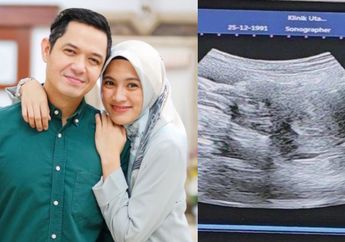 Selamat, Alyssa Soebandono dan Dude Harlino Dikaruniai Anak ke-3, sang Artis Spill Namanya yang Cantik Banget 