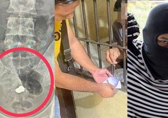 Astaghfirullah, Nyolong Gelang Emas 2,3 Gram, Maling di Cirebon Ini Nekat Menelannya, Begini Nasibnya yang Nyaris Dioperasi