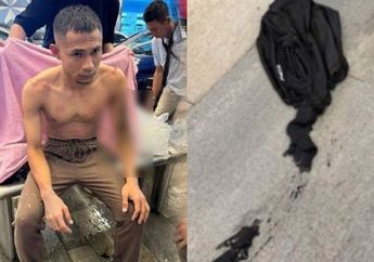 Innalillahi, Anggota Timnas ini Disiram Air Keras oleh Orang Tak Dikenal, Baju Meleleh Hingga Alami Luka Bakar