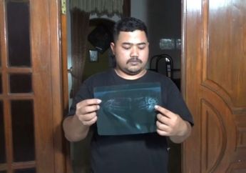Viral, Suami di Ngawi Cari Keadilan Usai sang Istri Meninggal Pasca Cabut Gigi Bungsu, Begini Kronologinya
