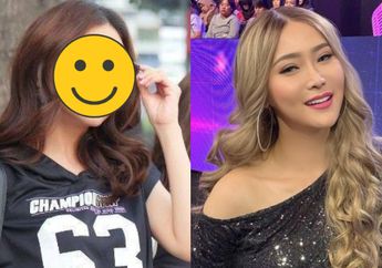 Wajah Baru Sarwendah Pasca Operasi Plastik, Dibilang Mirip Inul Daratista?