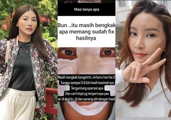 Akhirnya Wajah Baru Sarwendah Usai Oplas di Korea Terkuak, Paras Istri Ruben Onsu Bikin Pangling Tak Karuan, Netizen: Kok Jadi Lain