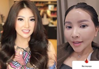 Bocor! Biaya Oplas Sarwendah di Korea Selatan, Istri Ruben Onsu Ditaksir Rogoh Kocek Segini Demi Dapatkan Wajah Mulus dan Awet Muda