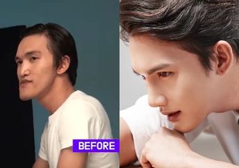 Sukses Operasi Plastik di Korea, Buruh Thailand ini Sampai Tak Dikenali Ibu Kandung, Wajah Aslinya Bikin Syok