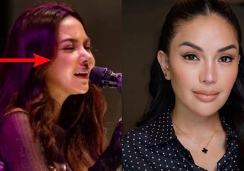 Nikita Mirzani Senggol Mahalini? Komentari Artis Operasi Hidung Gara-gara Sinus, Jangan Mau Dibohongin!