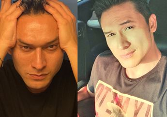 Operasi Plastik di Korea Selatan, Indra Bruggman Bongkar Bagian Tubuhnya yang Dirombak, Netizen: Udah Cakep Ngapain Oplas