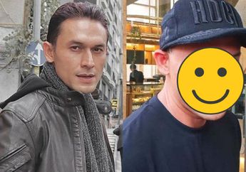 Bukan Sinus, Indra Bruggman Operasi Plastik ke Korea Selatan, Gara-gara Hipertiroid