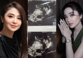 Dituduh Mandul, Dewi Perssik Murka hingga Pamer Bukti Hasil USG Ini, Sang Biduan Singgung Soal Karma: Lihat dan Tunggu!