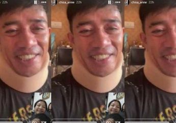 Sudah Bisa Senyum Lagi, Ruri Repvblik Sapa Anak-anaknya Melalui Video Call Usai Alami Kecelakaan Tunggal