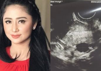 Capek Disebut Mandul, Dewi Perssik Lakukan Pembekuan Sel Telur, Ada 6 yang Aktif, Tunggu Diajak Nikah Aja