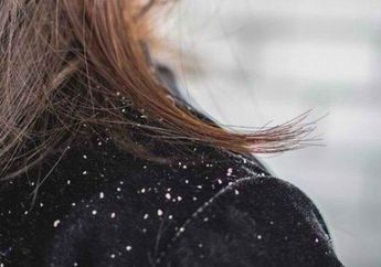 8 Tips Hilangkan Ketombe, Lakukan di Rumah dengan Rutin ya!