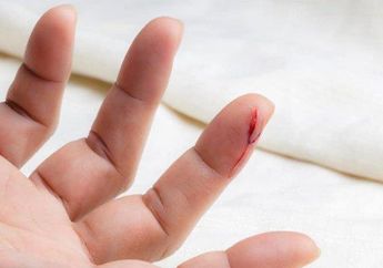 4 Arti Mimpi Tergores Pisau Pertanda Buruk, Simbol Konflik sampai Ada Luka Batin