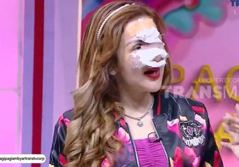 Dipancing Bunda Corla, Barbie Kumalasari Nekat Operasi Plastik Lagi