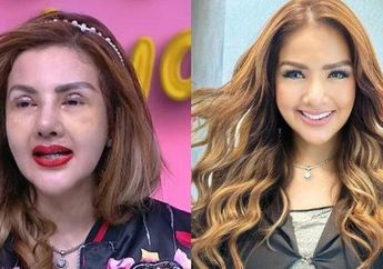 Terungkap Alasan Barbie Kumalasari Lakukan 4 Kali Operasi Hidung, Ternyata Sempat Alami Kondisi Ini: Sampai Nanahan