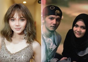 Gantengnya Saudara Kembar Rina Nose yang Jarang Terekspos Publik, Sang Artis Ungkap Hal Mengejutkan Ini: Hidungnya Lebih Mancung