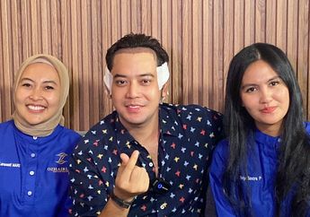 Alami Indikasi Kebotakan Sejak SMA, Kriss Hatta Jalani Transplantasi Rambut Demi Karier