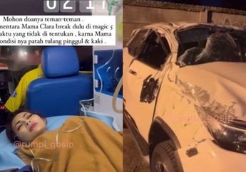 Profil Delia Yasmine, Pemain Sinetron yang Kecelakaan Semalam hingga Harus Operasi Kaki