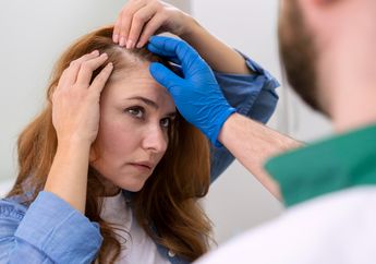 Populer di Kalangan Artis, Berikut Fakta Unik Mengenai Transplantasi Rambut