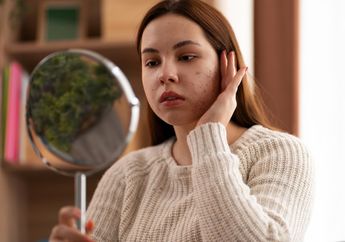 5 Kandungan Skincare untuk Mengatasi Komedo Putih, Stop Pakai Produk Abal-abal!